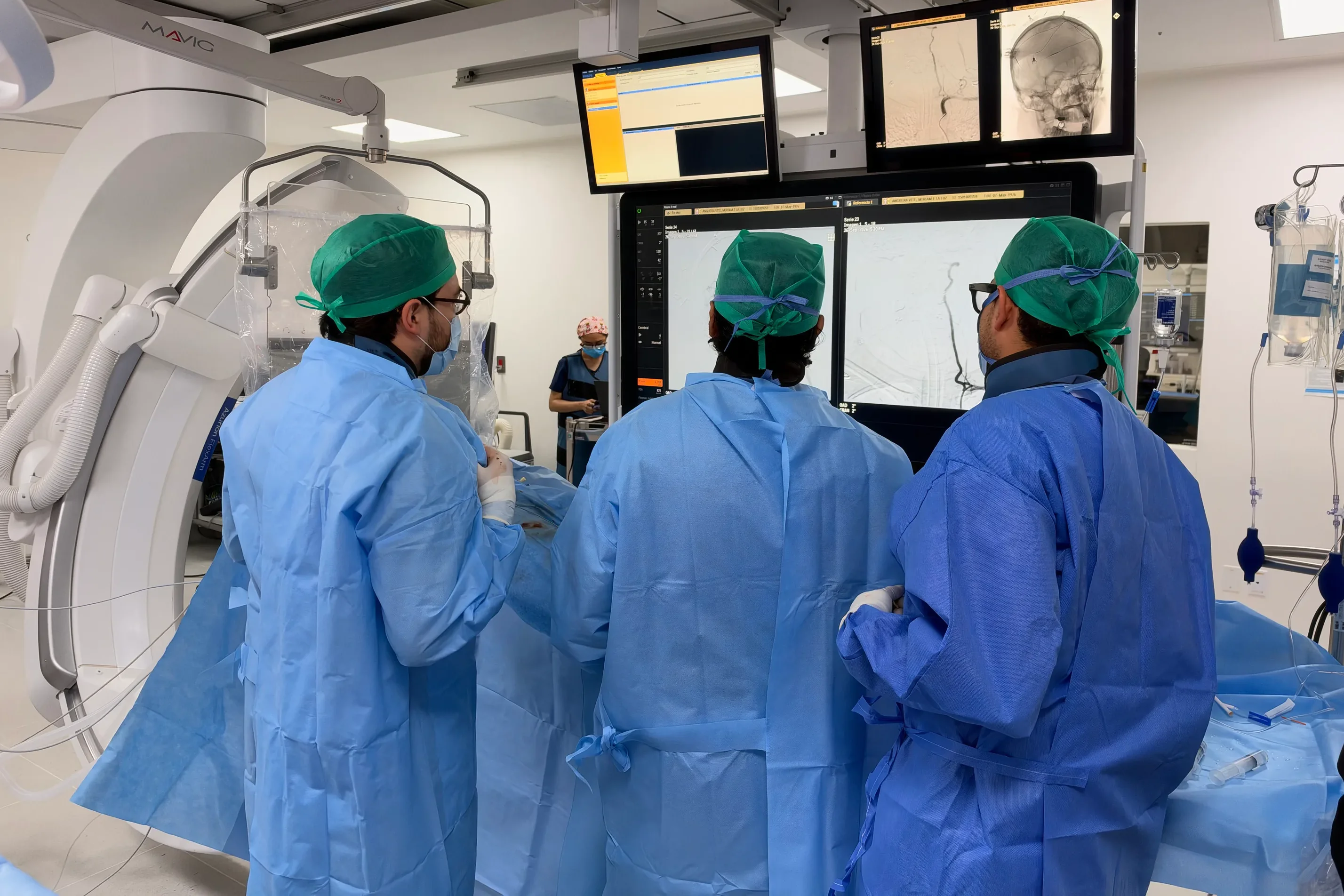 Embolización de aneurismas cerebrales