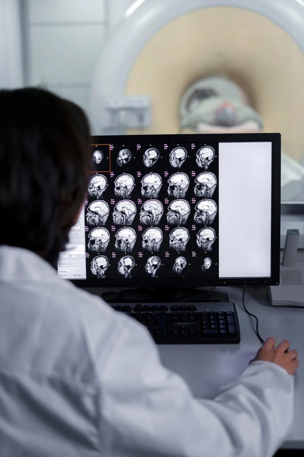 Testimonios sobre Neurocirugía y Terapia Endovascular Neurológica en CDMX